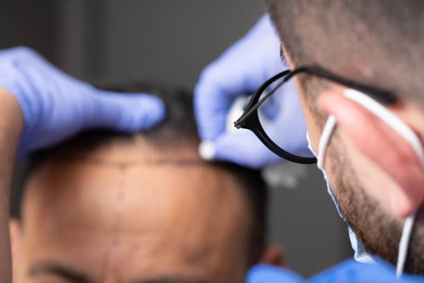 Hair Transplant in Dubai: Real Stories and Transformations